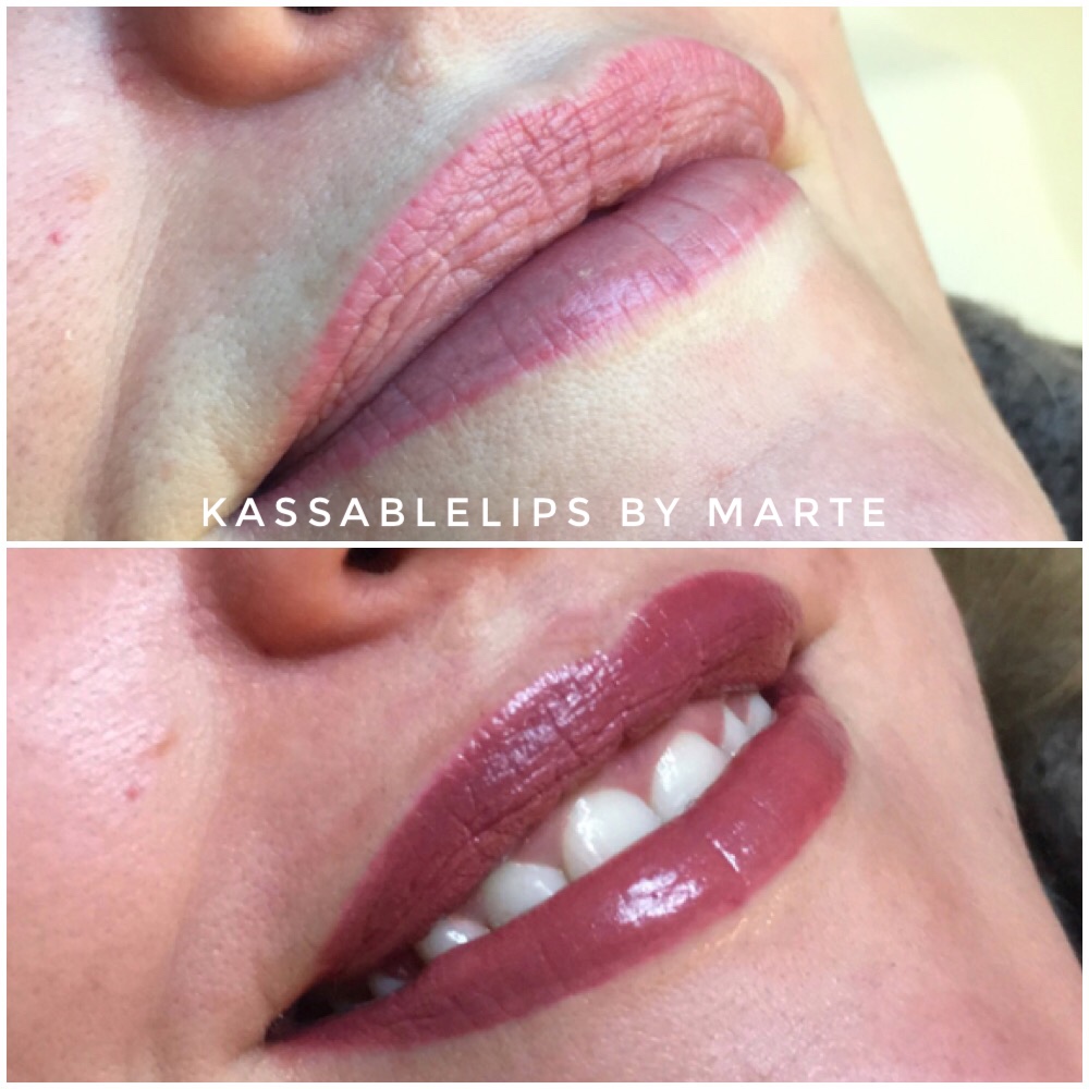 Permanente makeup – en behandling for alle.
