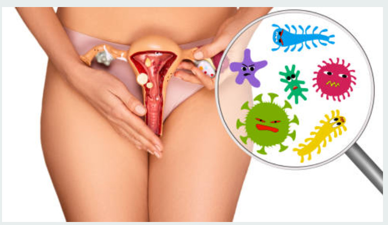 Vaginalt mikrobiom Nimo klinikken